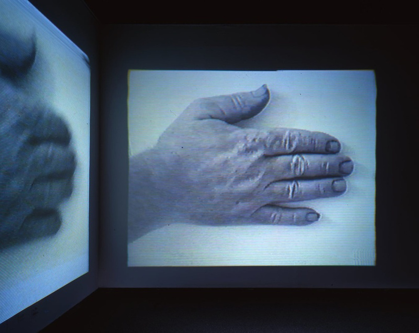 A black-and-white image of a human hand displayed on a screen, with the hand resting flat and fingers together. The screen is set within a dark environment, highlighting the illuminated hand.